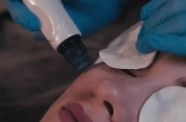 Hydrafacial