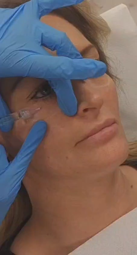 Polynukleotid-DNA-Therapie