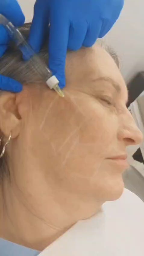 Polynukleotid-DNA-Therapie